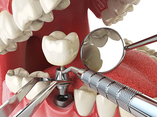 Best Urgent Care for Lost Fillings or Crowns in Vander, NC